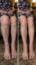 Illustrative before and after: tired, puffy legs and relaxed legs after using the Bellrose wrap